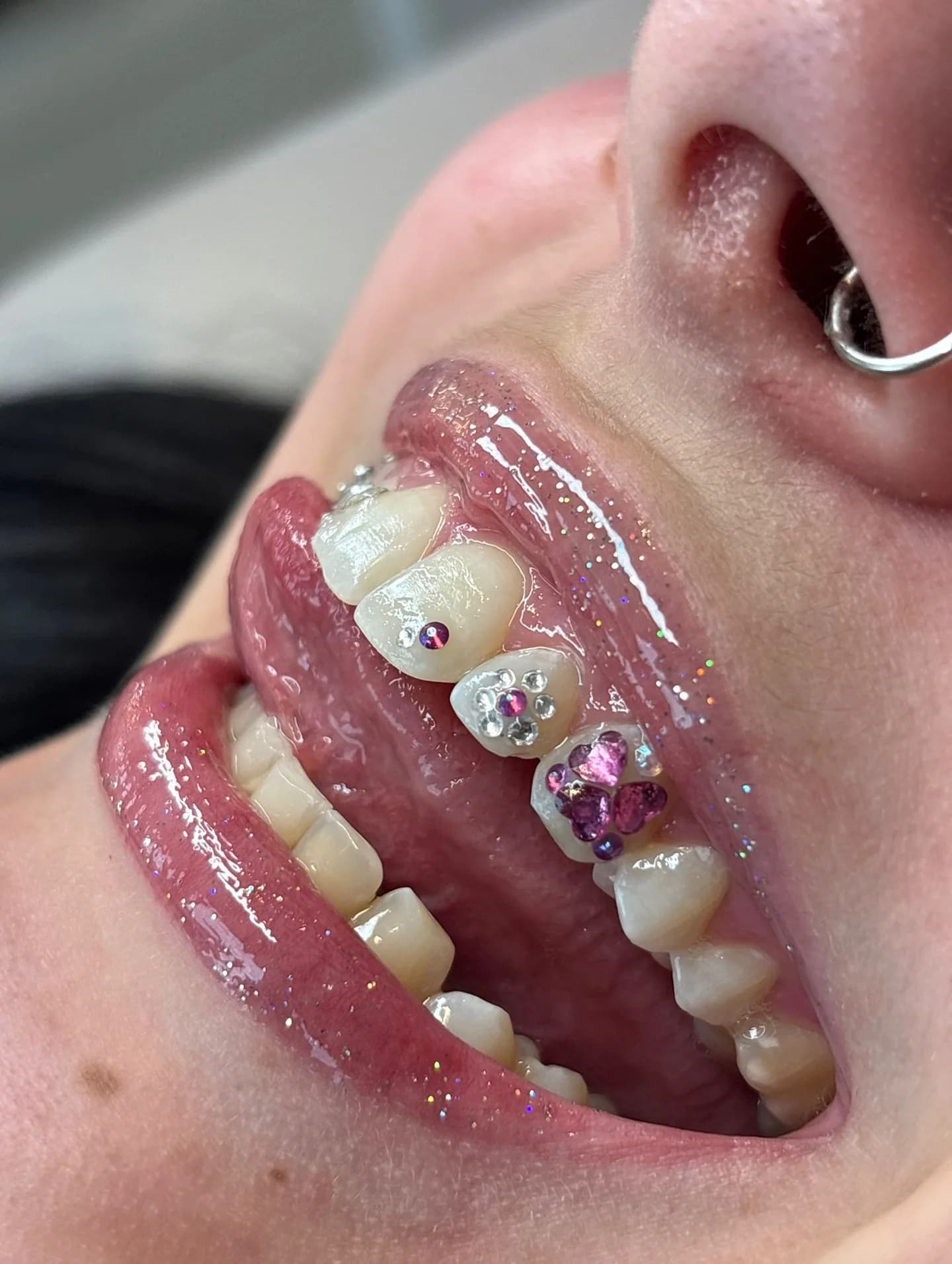 Strass Dentaire