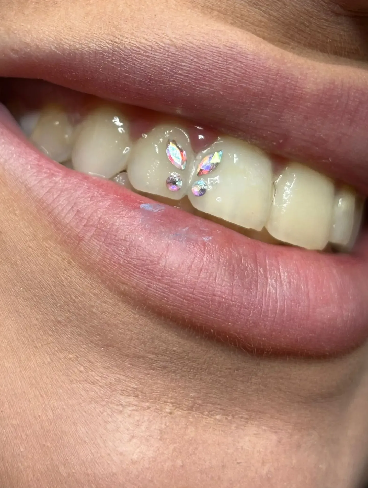 Strass dentaire — Suneva Beauty Toulon